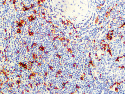 CD13