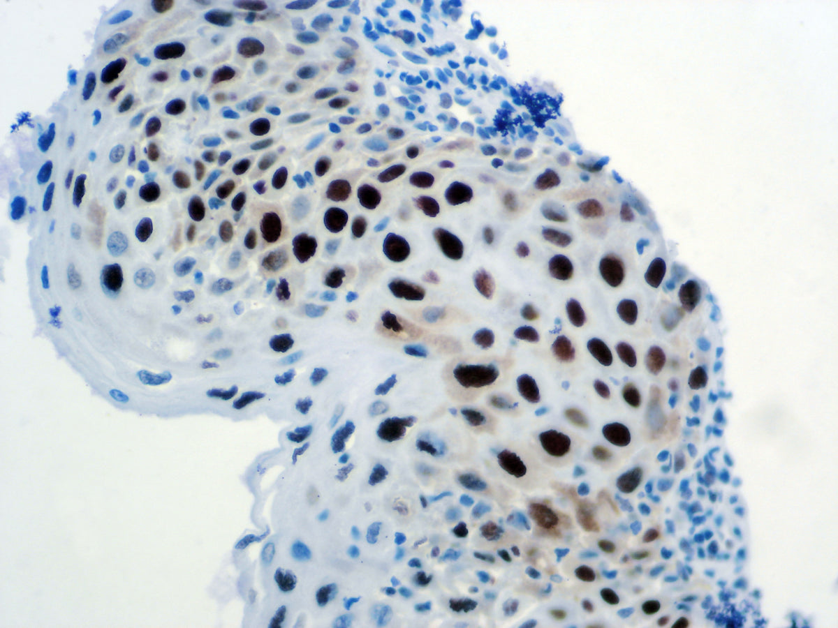 Topoisomerase IIa