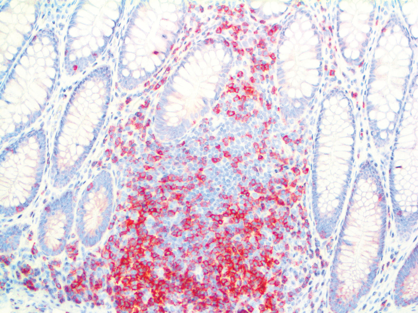 CD3