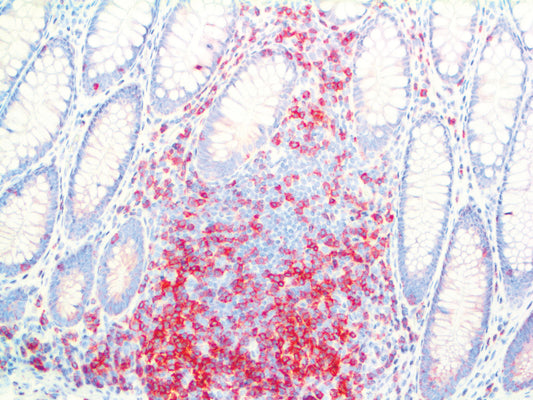 CD3