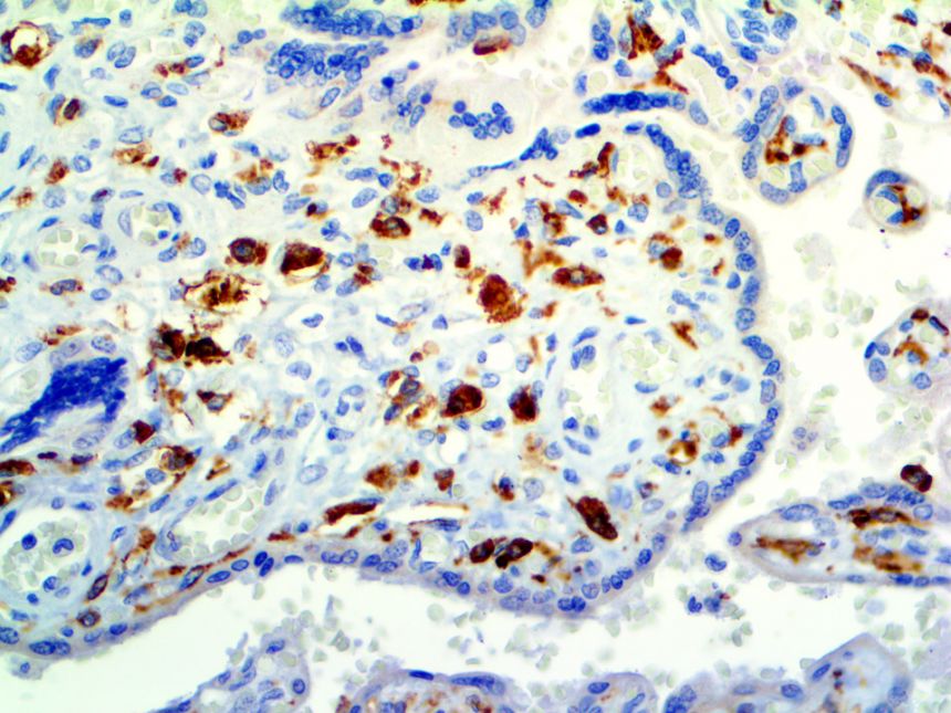 CD14
