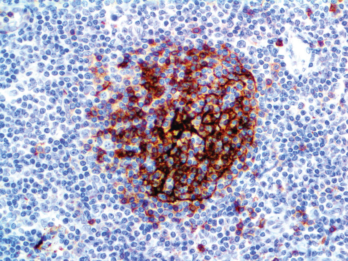 CD23