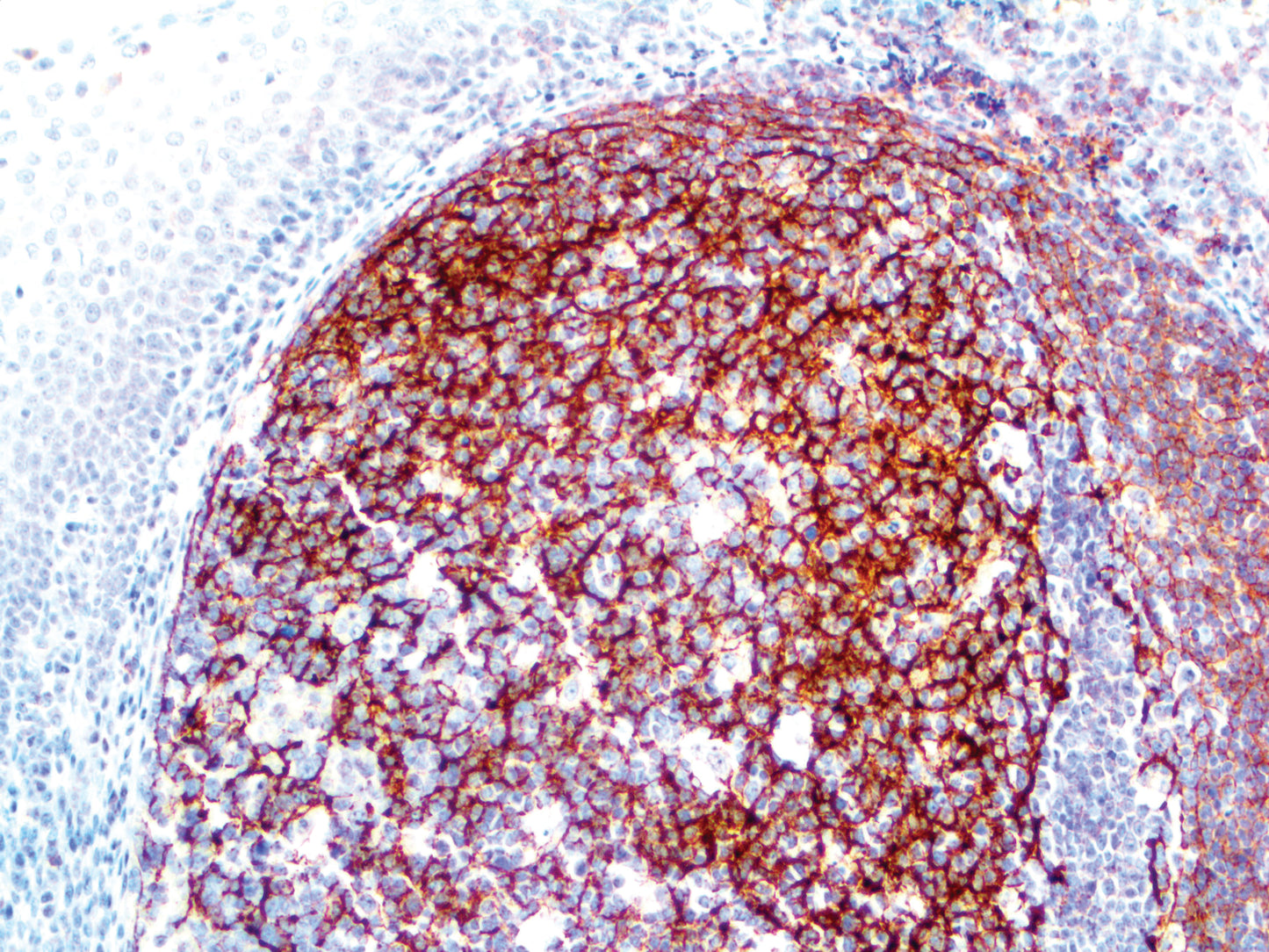 CD35