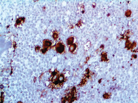CD41\Integrin alpha IIb