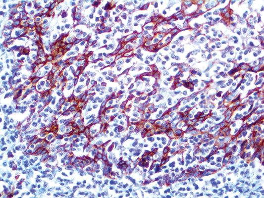 CD138