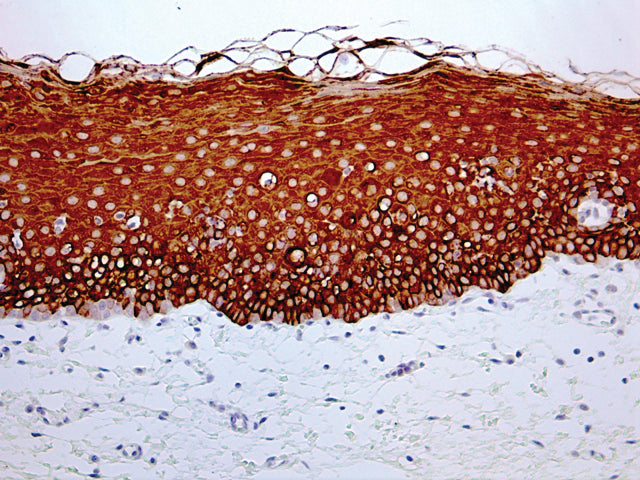 Cytokeratin 4