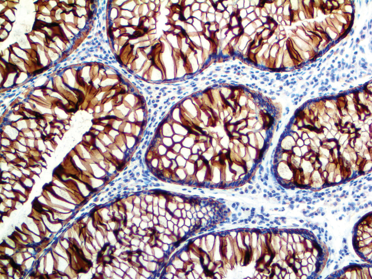 Cytokeratin 8