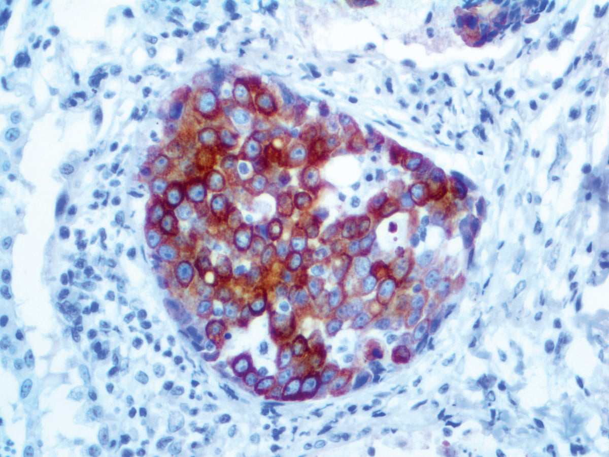Cytokeratin 20
