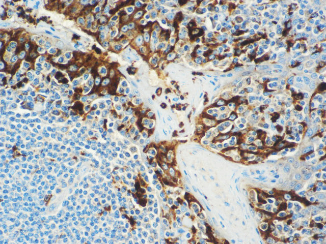 Lysozyme