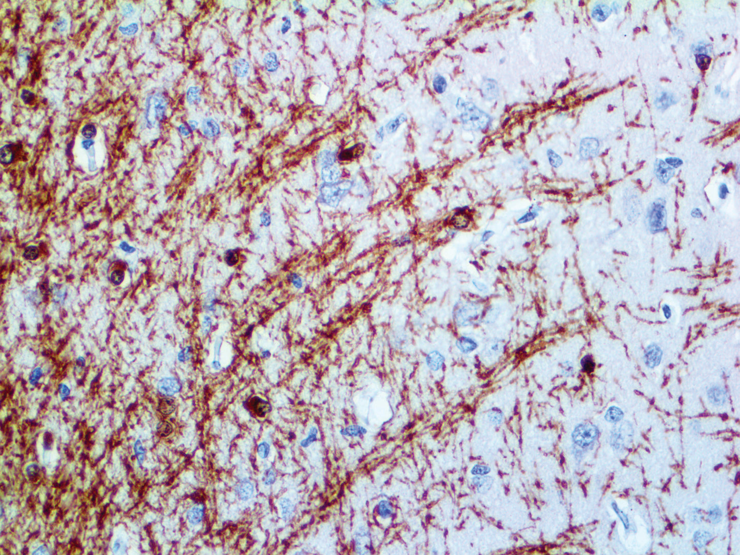 Myelin Basic Protein