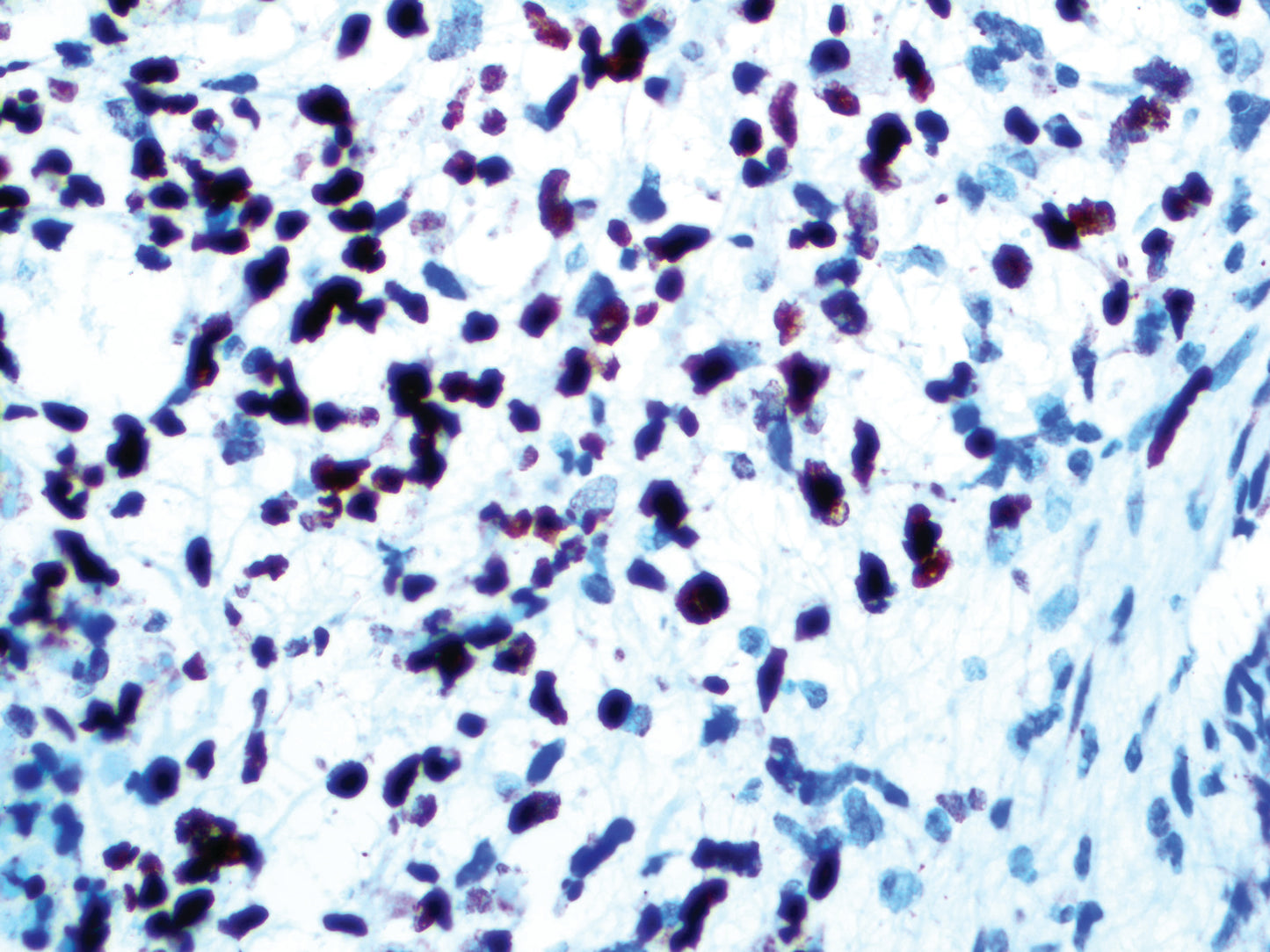MyoD1