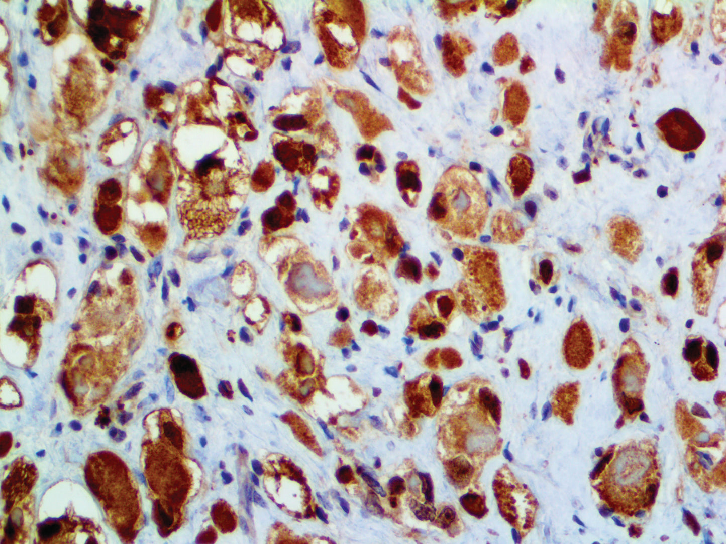 Myoglobin