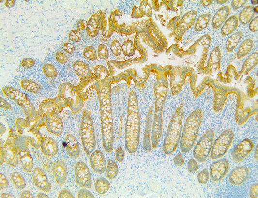 PolyDetector HRP Yellow