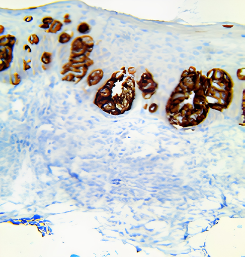 TintoFast EpCAM