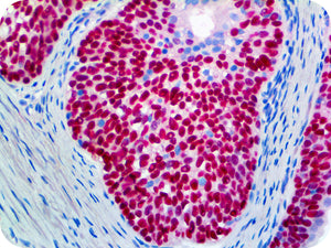 PolyDetector Alk Scarlet