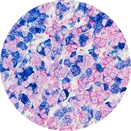 Automated Staining Instruments