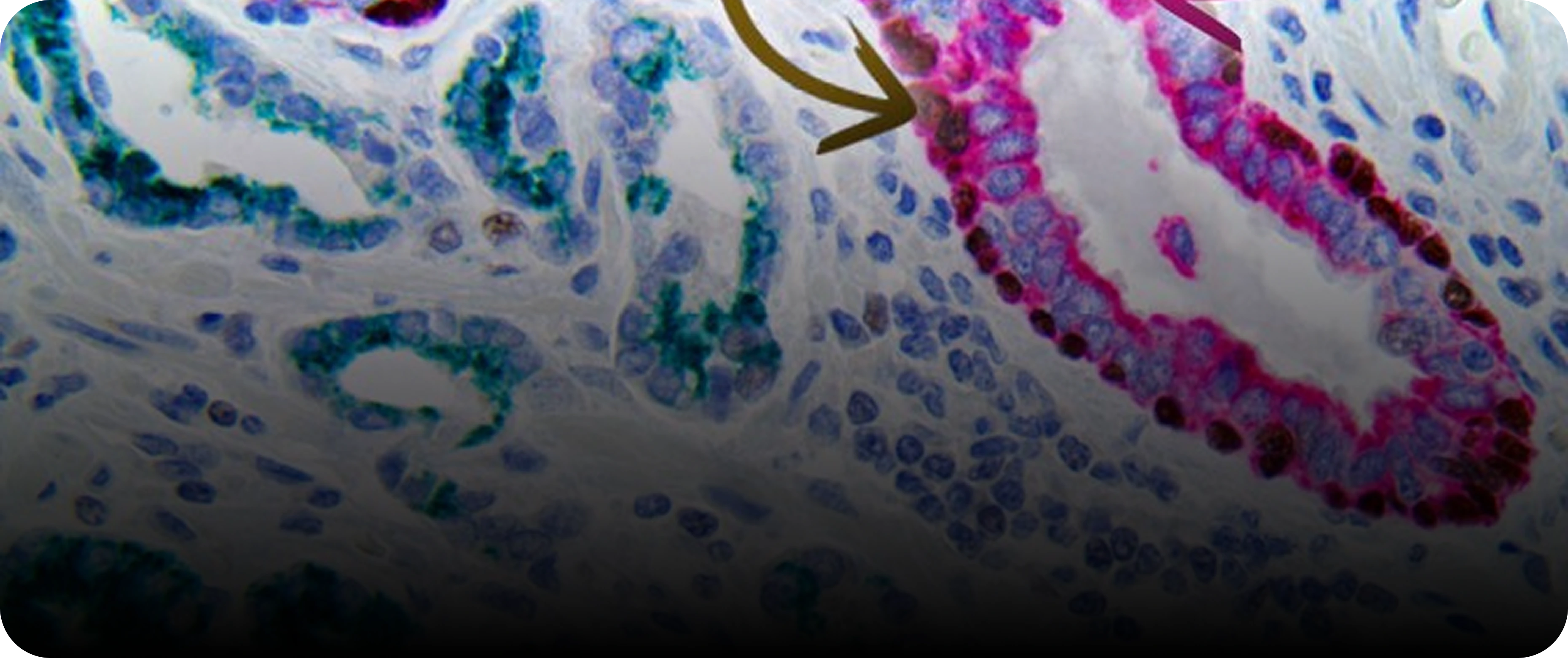 Multiplex Immunohistochemistry