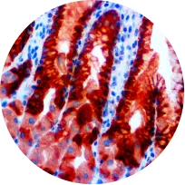 Substrate-Chromogens